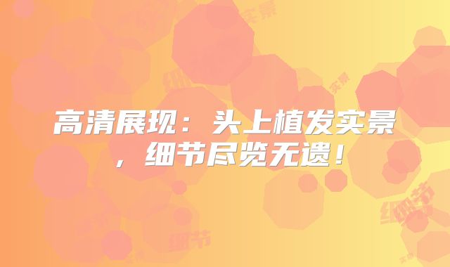 高清展现：头上植发实景，细节尽览无遗！