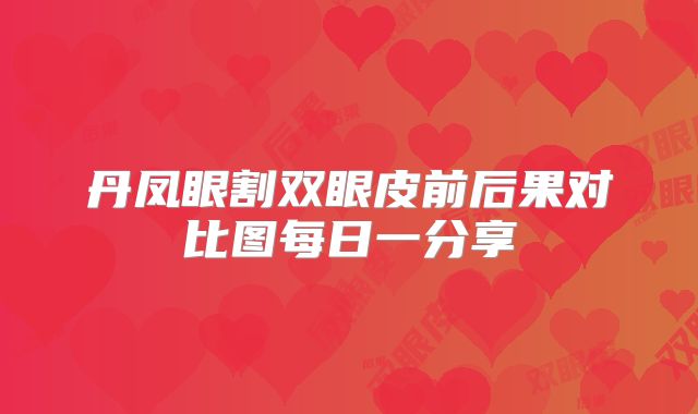 丹凤眼割双眼皮前后果对比图每日一分享