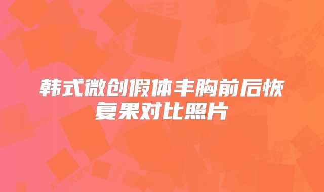 韩式微创假体丰胸前后恢复果对比照片