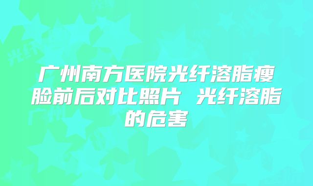 广州南方医院光纤溶脂瘦脸前后对比照片 光纤溶脂的危害