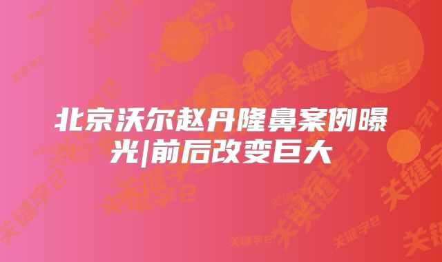 北京沃尔赵丹隆鼻案例曝光|前后改变巨大