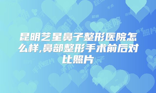 昆明艺星鼻子整形医院怎么样,鼻部整形手术前后对比照片