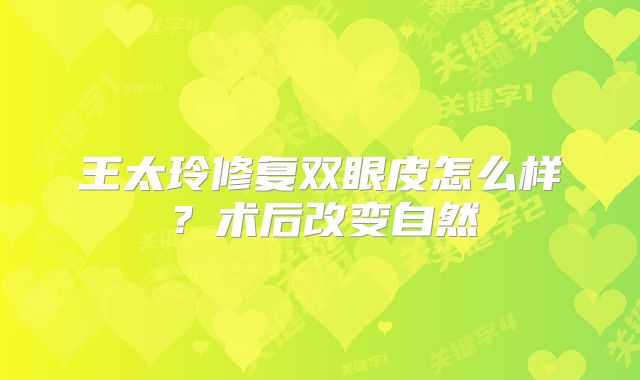 王太玲修复双眼皮怎么样？术后改变自然